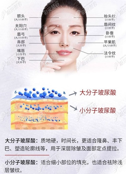 玻尿酸的作用與功效，深入了解玻尿酸的奧秘，玻尿酸的作用與功效揭秘，深入了解玻尿酸的神奇之處